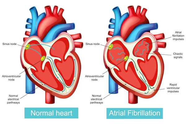 Structural Heart Disease