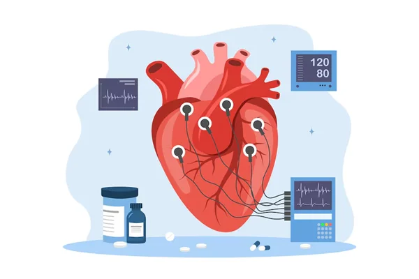 Electrophysiology Study